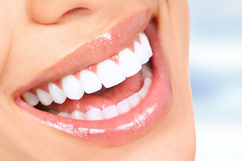 Cosmetic Dentistry (Veneers, Bonding & Whitening) in Apex